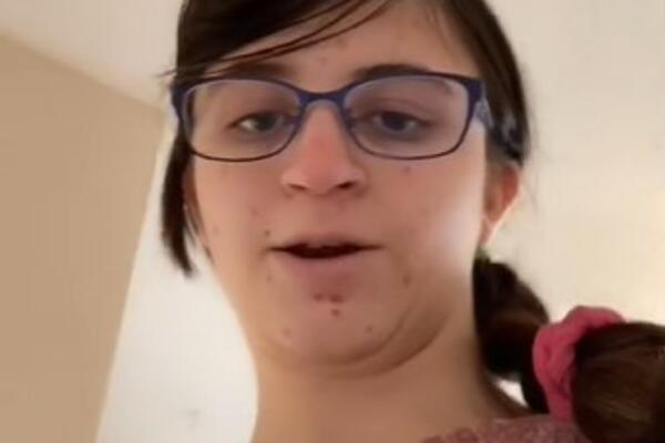 NOSI NAOČARE I LICE JOJ JE PUNO BUBULJICA, ALI... Kada joj vide 1 DEO TELA muškarci LUDE, pogledajte DOBRO (VIDEO)