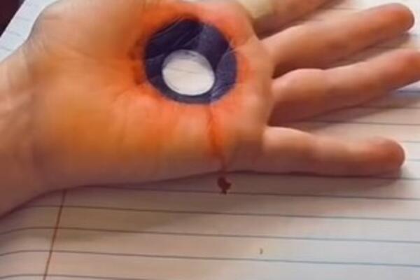 IZLUDELA SVET SVOJOM POJAVOM: Ima RUPU na dlanu, u nju GURA PRST, ljudi u ČUDU, šta je OVO?! (VIDEO)