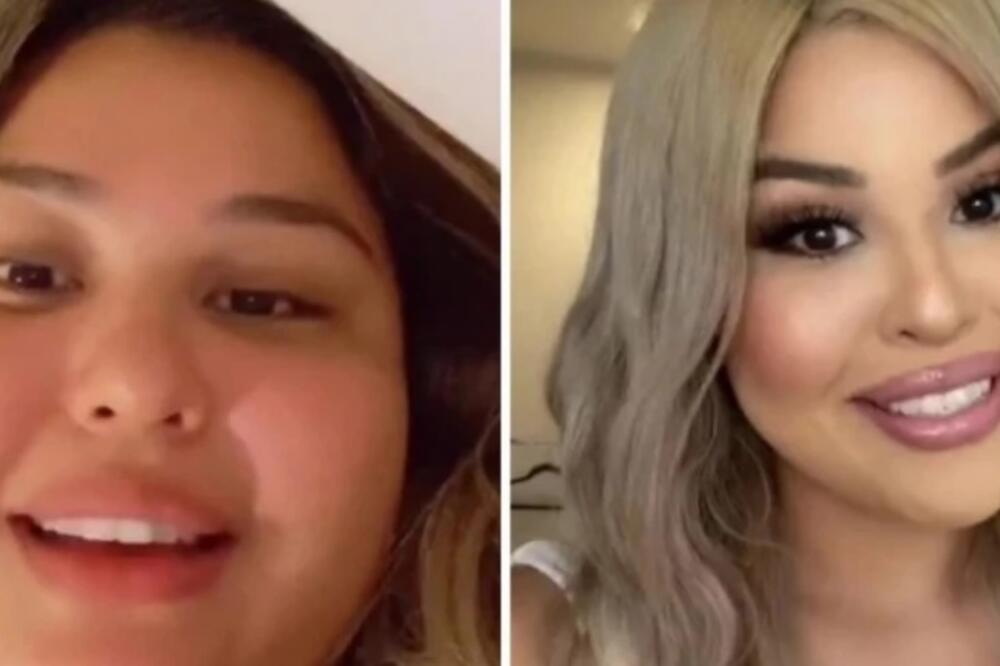 POKUŠAVALA JE DA SMRŠA 10 GODINA, PA OTIŠLA KOD LEKARA: Kad su je otvorili, sledili se, TO JE IMALO KOSU!