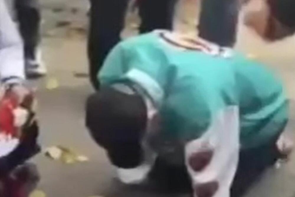 36 GODINA ŽIVEO SA OVIM U SEBI, A NIJE BIO NI SVESTAN: Imao je STOMAK kao TRUDNICA, a onda je saznao BIZARNU STVAR