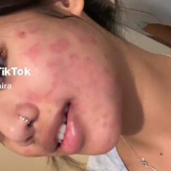 ZBOG OVOGA JOJ OPADA KOŽA SA LICA, A ŽENE GA SVAKODNEVNO KORISTE: Razmislićete kada se sledeći put budete ŠMINKALE