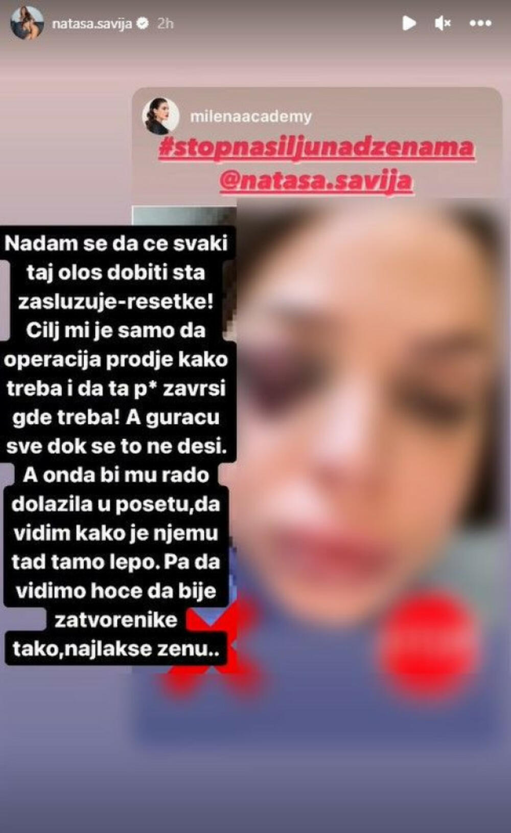 Šavija je u Urgentni centar Vojvodine primljena sa višestrukim povredama glave i lica u vidu fraktura, hematoma i ogrebotina, te danas čeka na operaciju