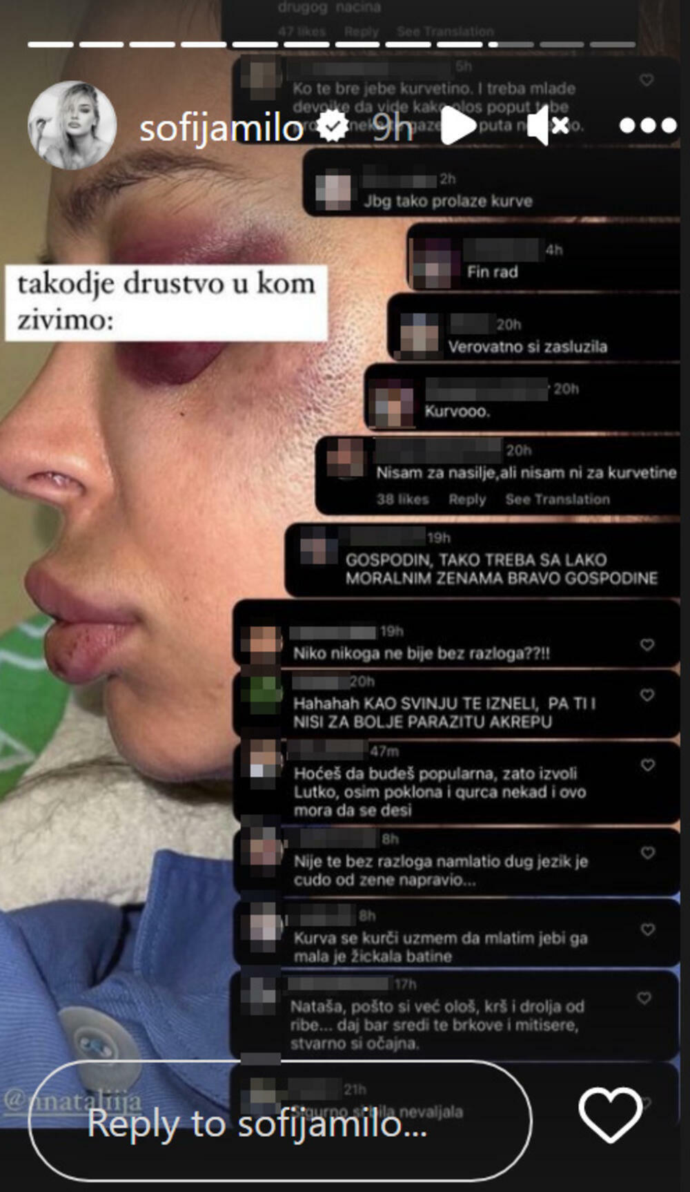 Stravično nasilje koje je doživela starleta Nataša Šavija potreslo je mnoge