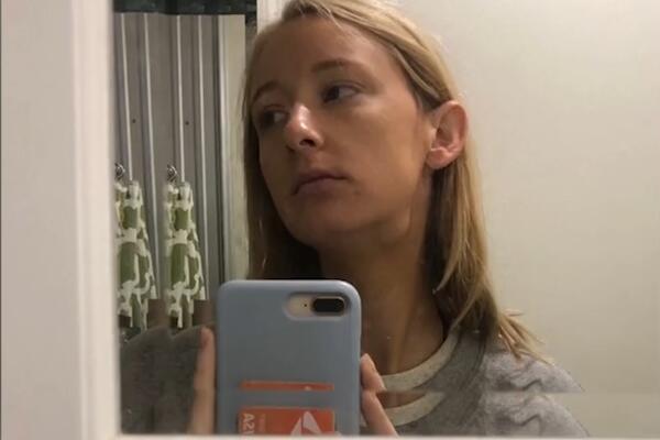 SNIMALA TIK TOK VIDEO, PA SAZNALA DA IMA RAK: Sve se desilo zbog jednog simptoma koji je primetila na kameri