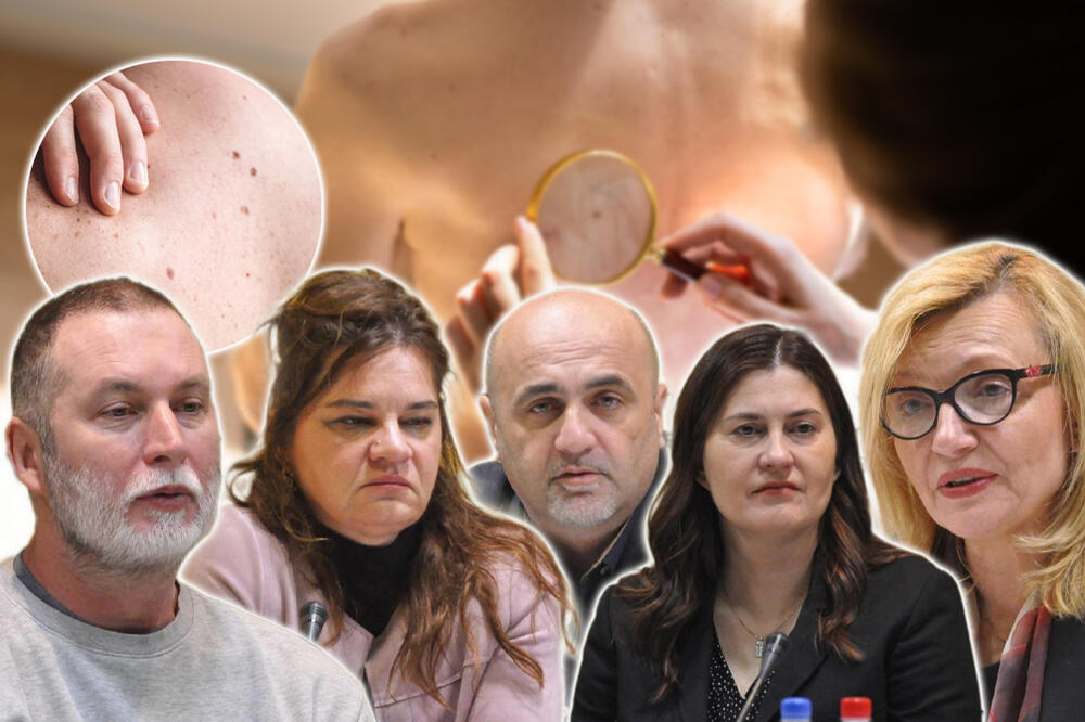 MELANOM JE NAJOPASNIJI RAK KOŽE: Može se naći i u OVOM organu, struka apeluje - SAMO SE OVAKO MOŽE IZLEČITI!