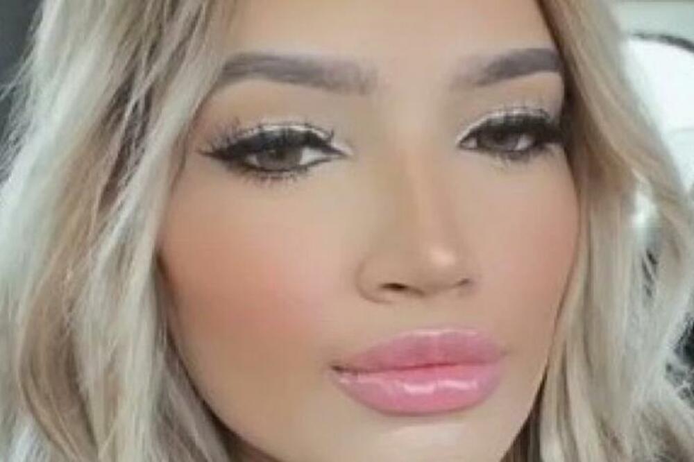 OVA DEVOJKA JE KAO ANĐEO, ALI KADA VIDITE NJENO LICE... Muškarci se DRŽE za GLAVU, da li je OVO MOGUĆE?! (VIDEO)