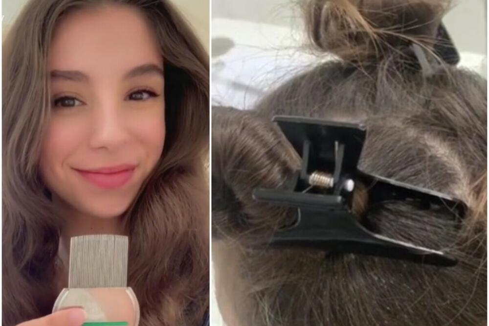 PREVRNUĆE VAM SE ŽELUDAC KAD BUDETE VIDELI ŠTA JE FRIZERKA IZVUKLA IZ KOSE: Kakve su ovo BELE LOPTICE? (VIDEO)