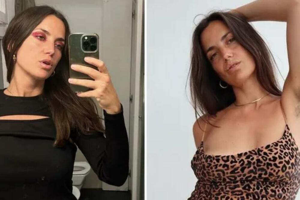 NIJE SE BRIJALA GODINAMA I SADA ZARAĐUJE NA DLAKAMA: Otkrila koja je MESEČNA CIFRA koju dobija (FOTO)