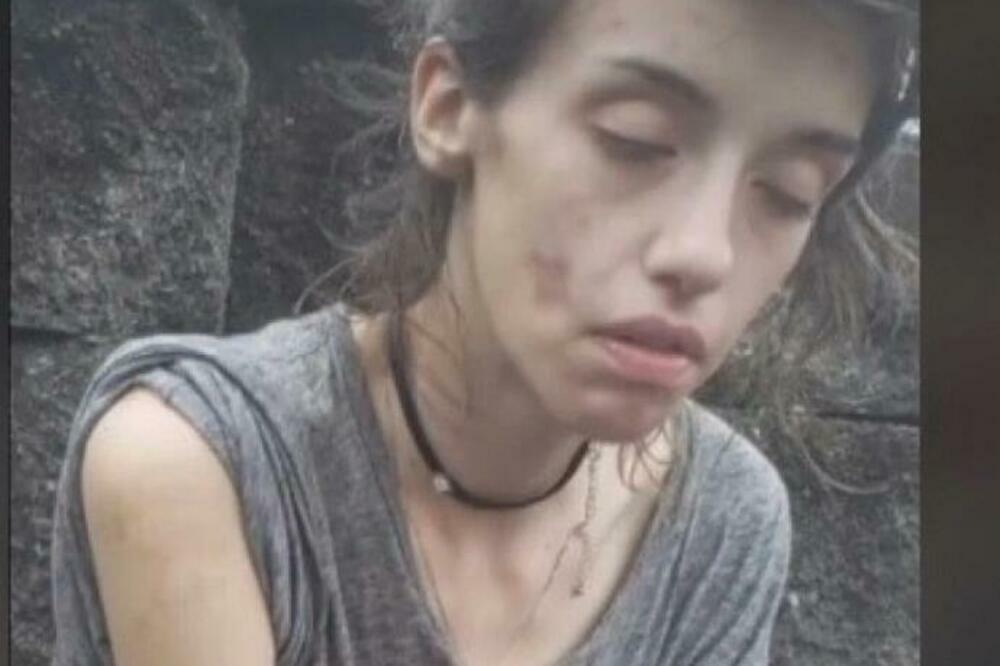 DROGA JE RASTAVILA OD ŽIVOTA, SPASILA JE VIŠA SILA: Pogledajte kako izgleda DANAS, promena za NEVERICU