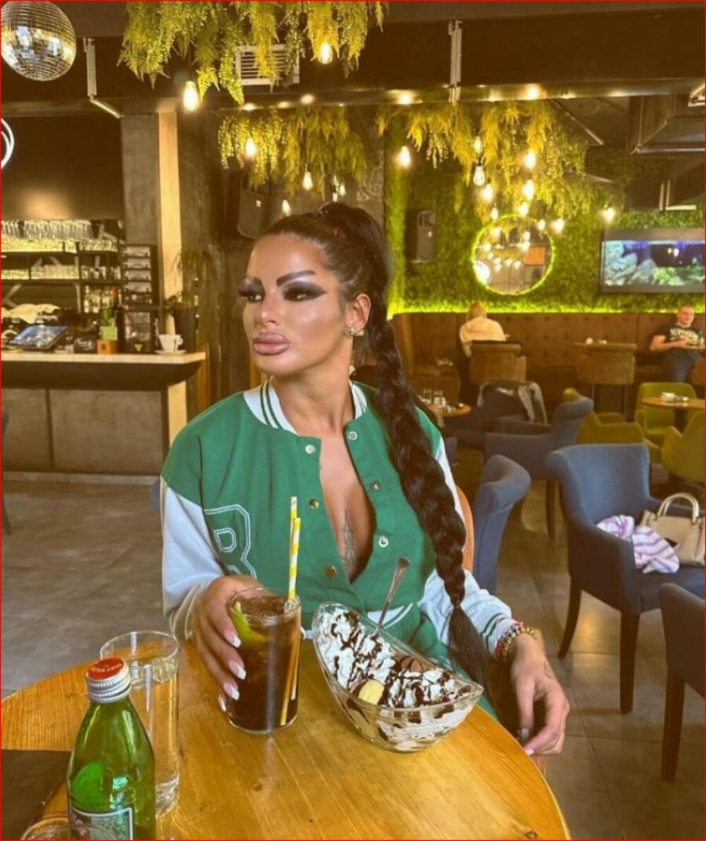 Snežana Bogdanović operacija nosa