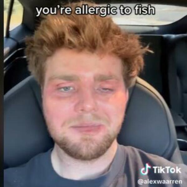 SLIKA IZDEFORMISANOG POZNATOG PEVAČA KRUŽI INTERNETOM: Jedno OKO mu zatvoreno, na drugo JEDVA GLEDA (VIDEO)