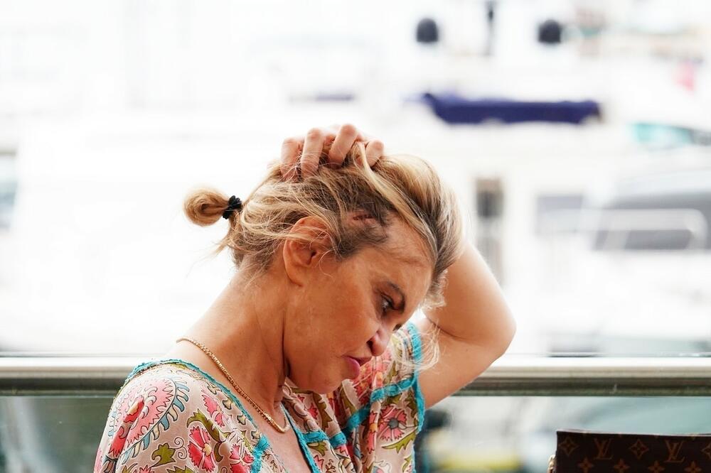 DANIJELA OTIŠLA U TURSKU DA POVRATI LICE, A ZAVRŠILA SA RUPOM U GLAVI: Mora na još jednu OPERACIJU (FOTO)