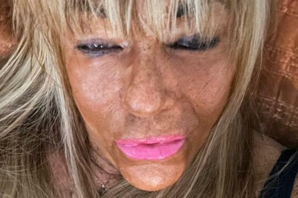 POSLE OVE ŽENE ĆETE DOBRO RAZMISLITI DA LI ĆETE IĆI U SOLARIJUM: A tek šta je uradila svom DETETU, JEZIVO (VIDEO)