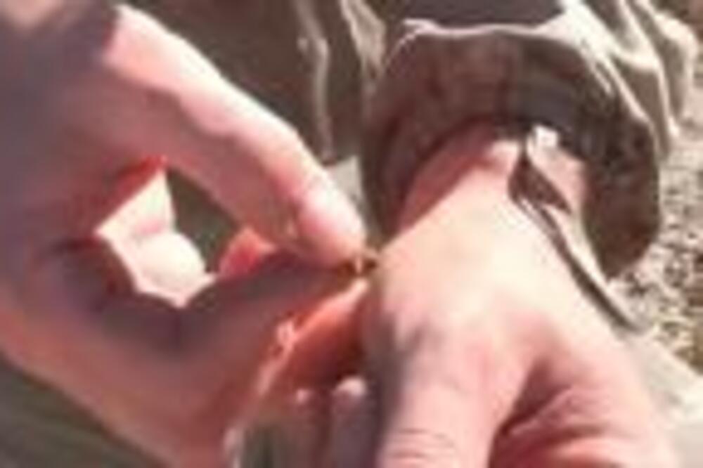 PČELAR OTKRIVA ŠTA ODMAH DA URADITE KADA VAS UJEDE PČELA: Svi prave istu GREŠKU, CAKA je u ovom POKRETU (VIDEO)