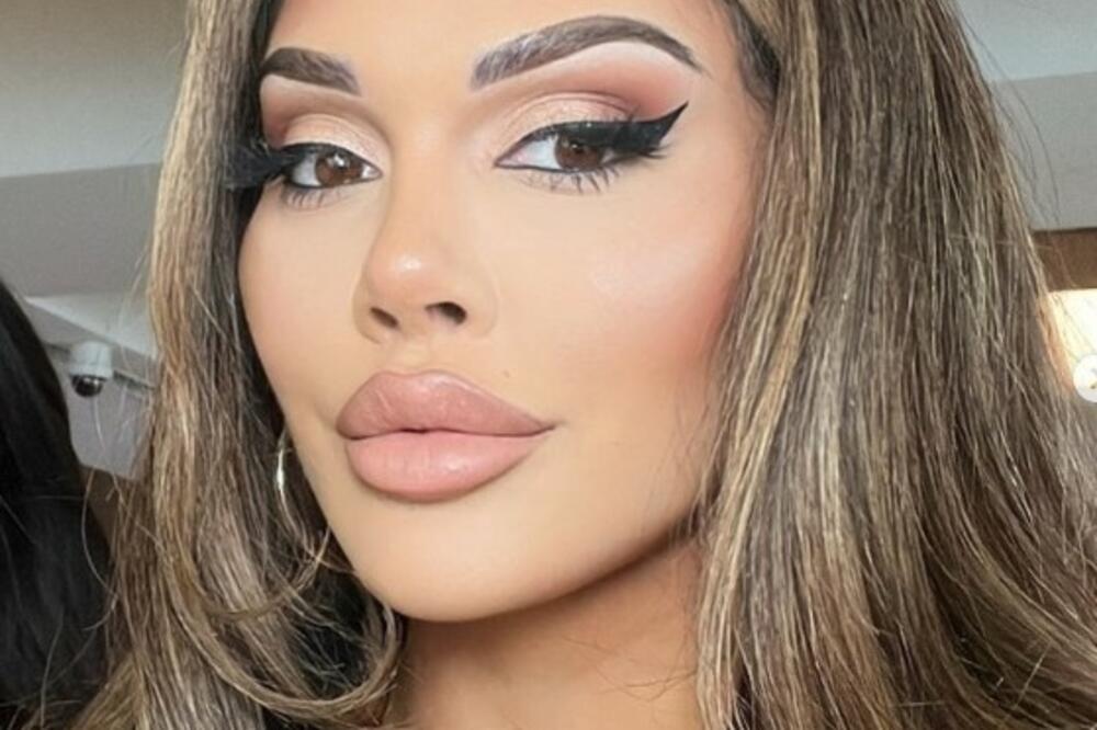 OTIŠLA U TURSKU DA ZATEGNE OČI, A SVI OSULI PALJBU NA NJU: Kada se OPERISALA, GLEDALI su u JEDNU STVAR (VIDEO)