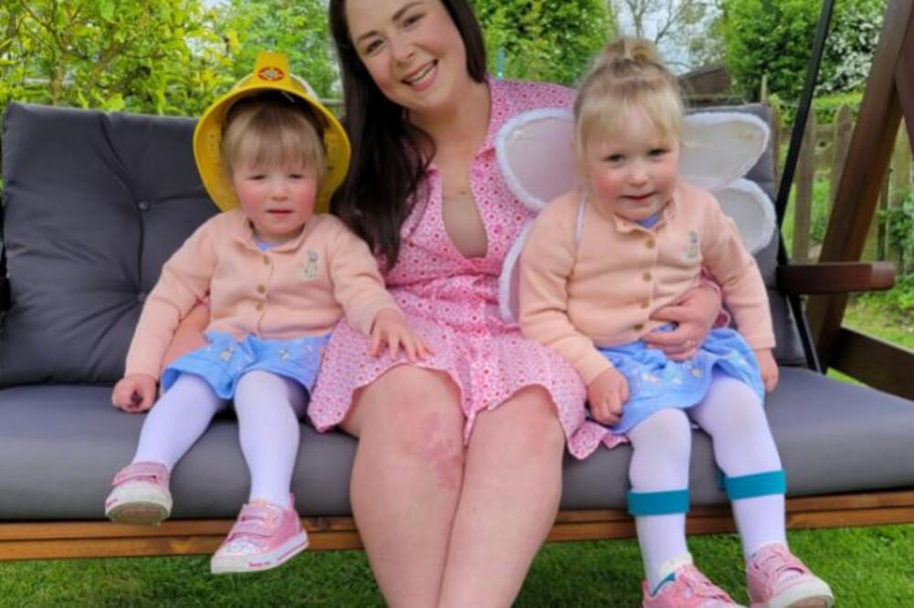 ZATRUDNELA DOK JE VEĆ BILA TRUDNA: Mislila da nosi blizance, pa postala medicinski FENOMEN (FOTO)