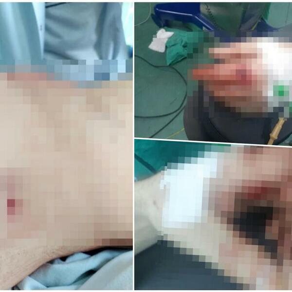 ČUO SE RAFAL, OSETIO SAM METAK OTPOZADI: Ranjeni Dragiša Galjak iz šok sobe POSLAO PORUKU SVIM SRBIMA!