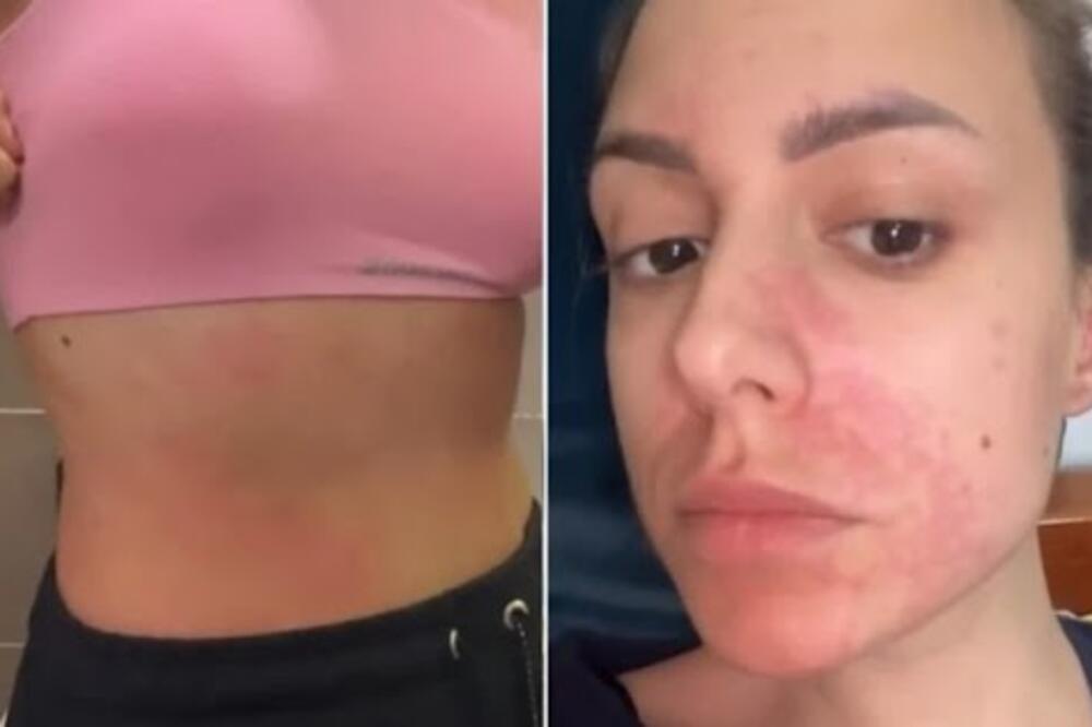 POJELA JE SLADOLED, PA ZAVRŠILA U URGENTNOM CENTRU: Katarinina priča je neverovatna, doktori se šokirali! (FOTO)