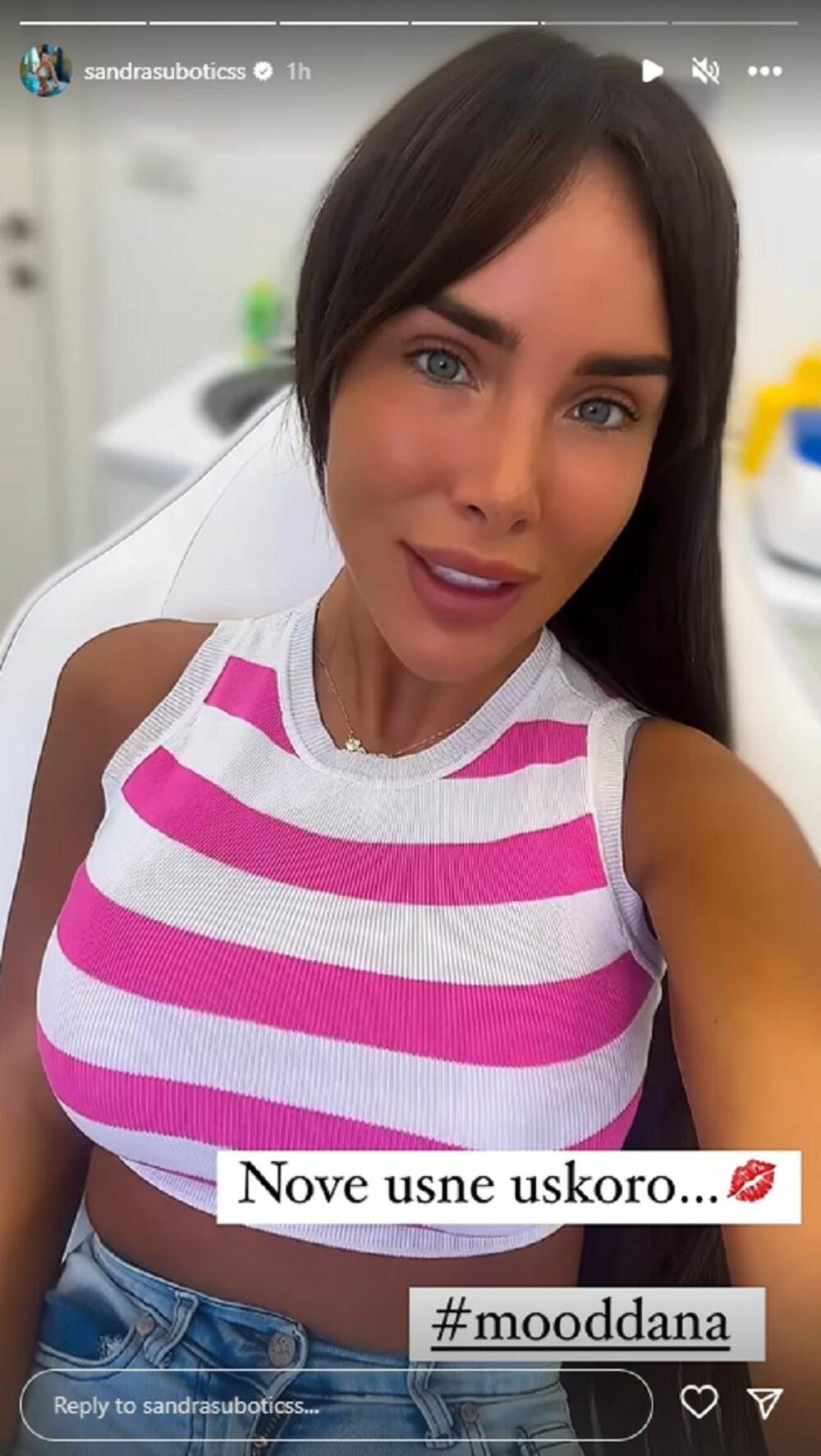 Aleksandra Subotić o novim usnama