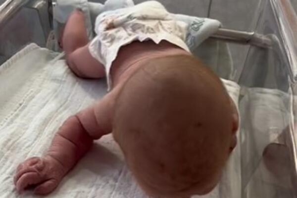NA POROĐAJU LEKARI SU VIDELI DA NEŠTO VIRI IZ BEBE: Kad su pogledali malo bliže, sablaznili su se