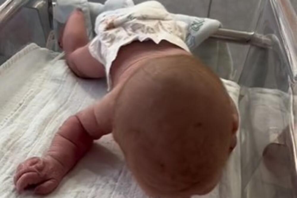 NA POROĐAJU LEKARI SU VIDELI DA NEŠTO VIRI IZ BEBE: Kad su pogledali malo bliže, sablaznili su se