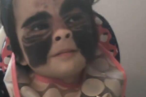 ZVALI JE "BETMEN" ZBOG LICA, A DANAS JE PRAVA LEPOTICA: Kad vidite kako izgleda POSLE ZAHVATA, bićete u ŠOKU (FOTO)