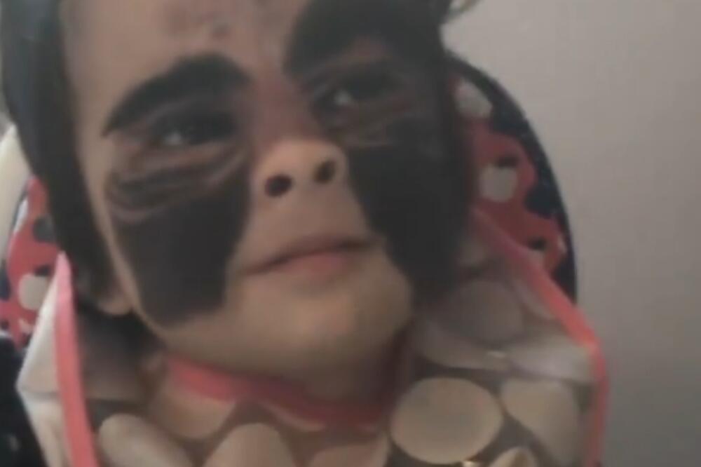 ZVALI JE "BETMEN" ZBOG LICA, A DANAS JE PRAVA LEPOTICA: Kad vidite kako izgleda POSLE ZAHVATA, bićete u ŠOKU (FOTO)