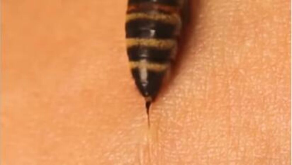 Evo šta da radite ako vas ubode osa ili pčela