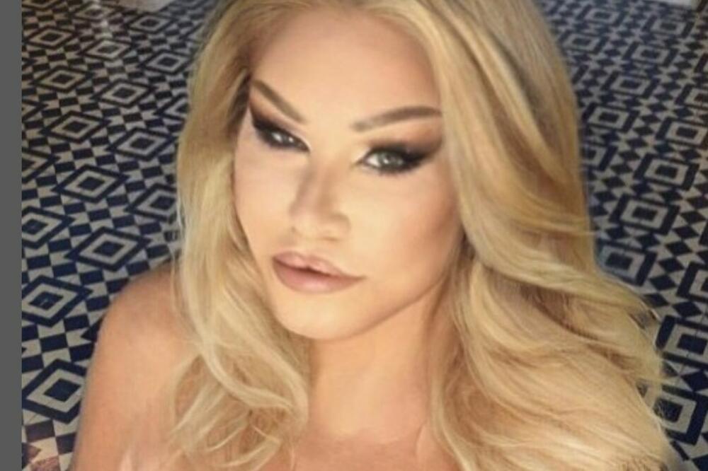 O LEPOTI ŽENE MAČKE BRUJAO JE CEO SVET: Evo kako sada izgleda nakon svih OPERACIJA (FOTO)