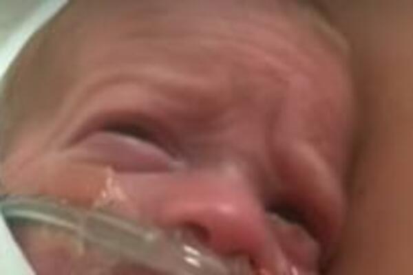 RODILA TROJKE KOJE SU MOGLE DA STANU U ŠAKU: Najteža imala KILOGRAM I PO, evo kako DANAS izgledaju (VIDEO)