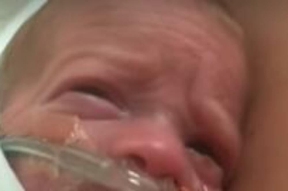 RODILA TROJKE KOJE SU MOGLE DA STANU U ŠAKU: Najteža imala KILOGRAM I PO, evo kako DANAS izgledaju (VIDEO)