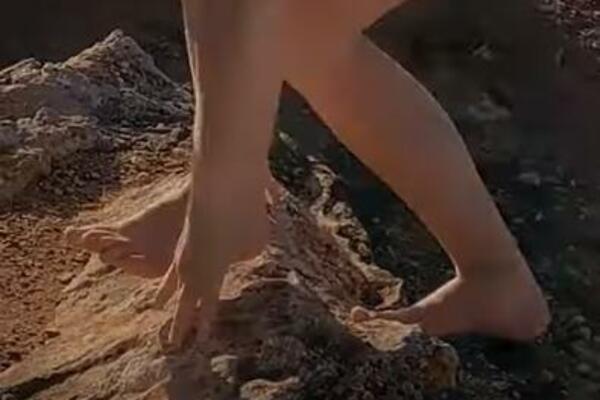 GODINU DANA NIJE NOSILA OBUĆU, A SAD JE SNIMILA KAKO JOJ IZGLEDAJU STOPALA: Ljudi su ZANEMELI na OVE PROMENE