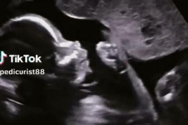 SNIMILI BEBU ULTRAZVUKOM, A ONDA SU ZANEMELI OD ŠOKA: Zbog onog što je RADILA u STOMAKU, pašćete u nesvest (VIDEO)