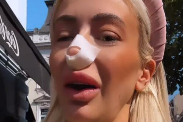 DUŠICA JAKOVLJEVIĆ IMALA OPERACIJU, EVO KAKO IZGLEDA: Voditeljka cela u ZAVOJIMA, tu je FOTKA iz BOLNIČKE POSTELJE