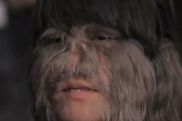 DA LI SE SEĆATE NAJDLAKAVIJE DEVOJKE NA SVETU? Šokirala i roditelje, a gledajte kakvu je TRANSFORMACIJU IMALA! FOTO