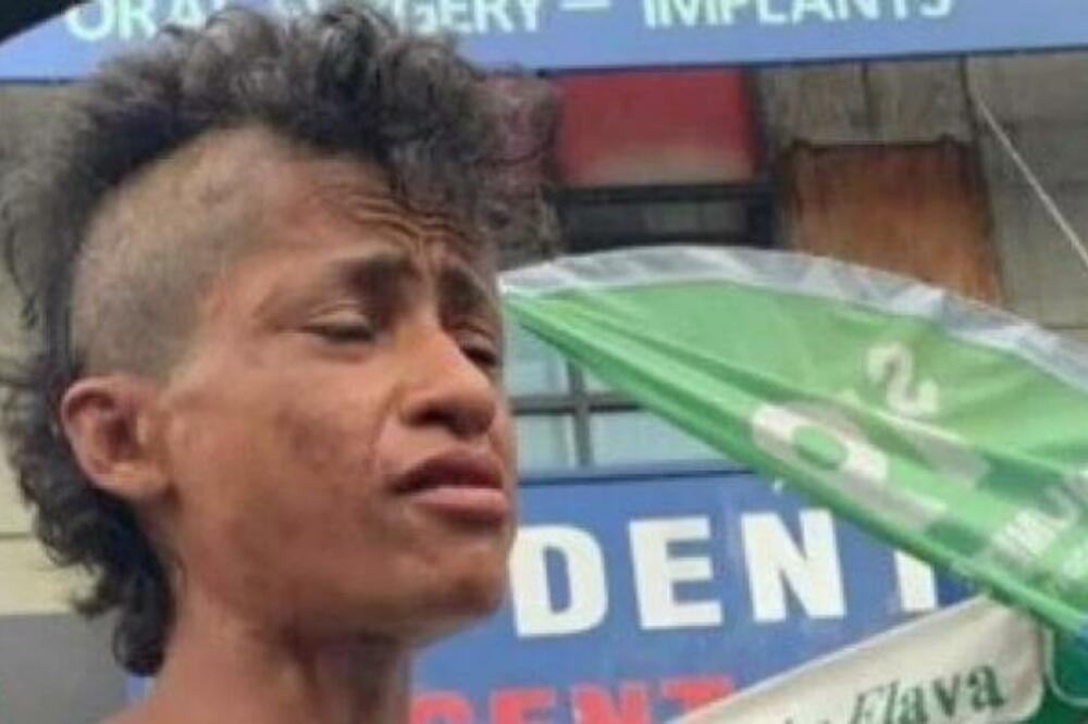 NA ULICI SU ZATEKLI UNAKAŽENU, ZAPUŠTENU ŽENU U RITAMA: Bila je zavisna od DROGE, a onda su SHVATILI o KOME JE REČ