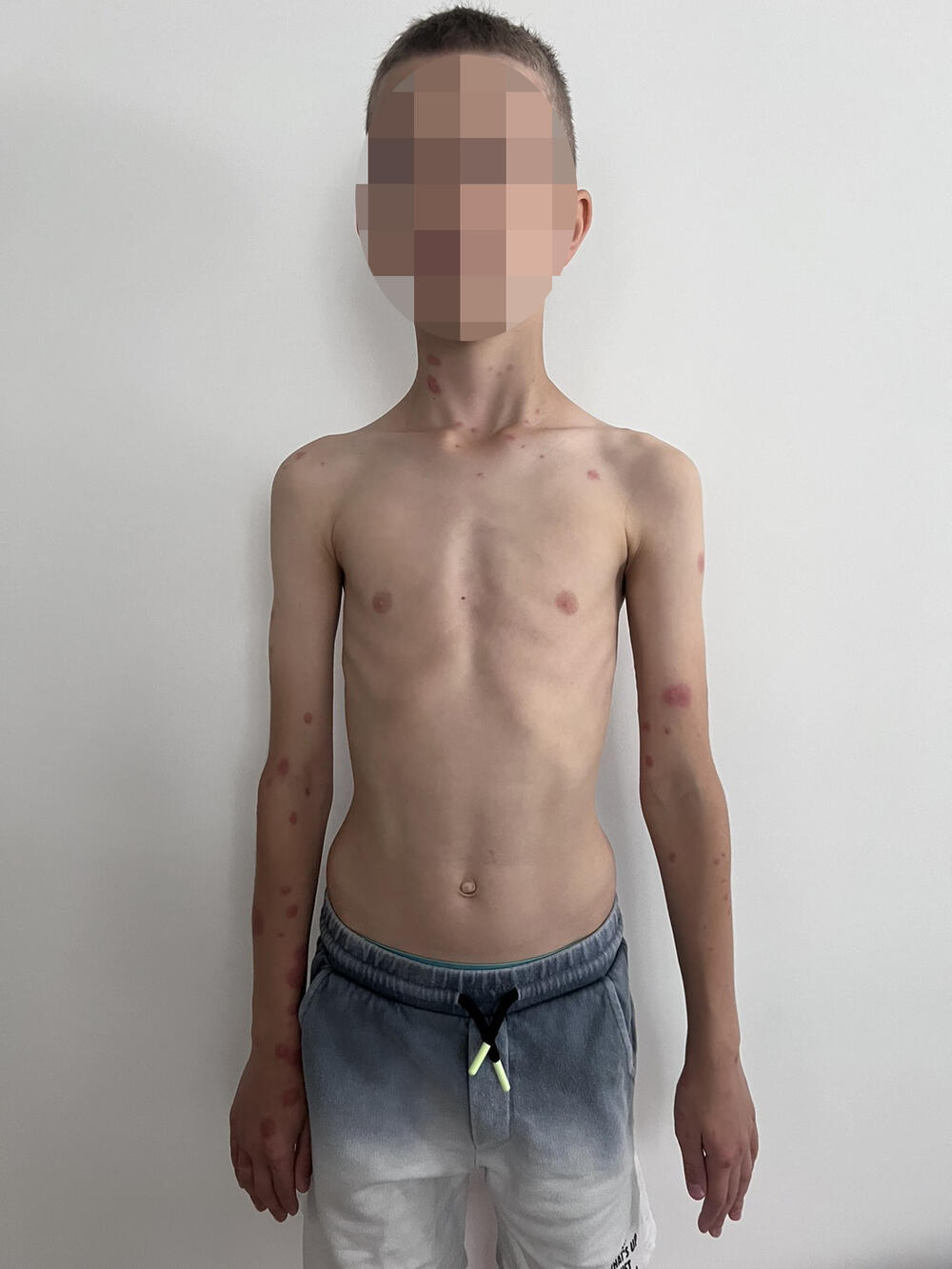 Stenice, rekreativna, Ekskurzija