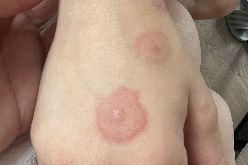 OVO JE JASAN DOKAZ DA IMATE OPASNE BUBE U KUĆI: Žive na - 15 ali i PLUS 40, Evropa je u PANICI ZBOG njihovog UGRIZA