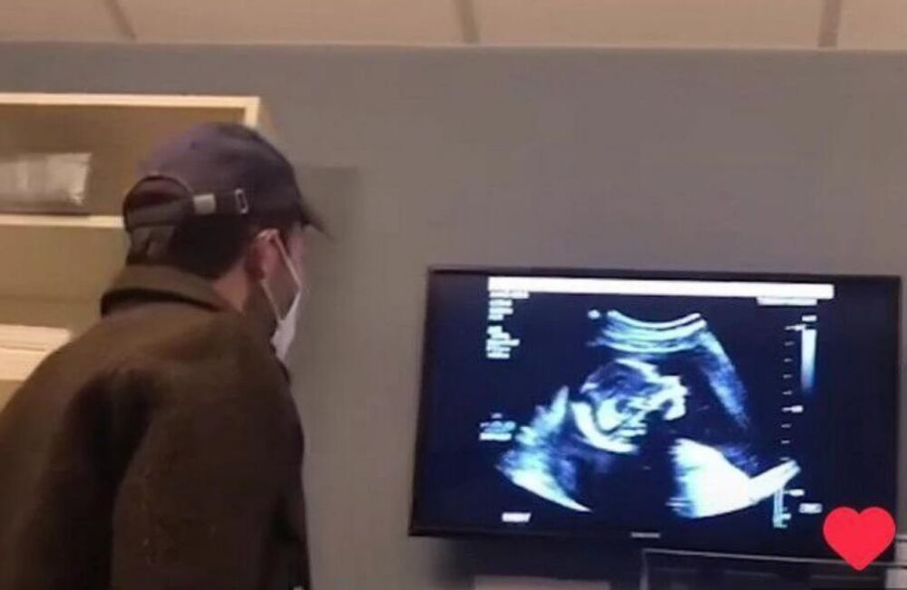 PONOSNI OTAC OTIŠAO SA DEVOJKOM NA ULTRAZVUK, A ONDA NIJE ZNAO ŠTA GA JE SNAŠLO: Nije mogao da VERUJE ŠTA VIDI