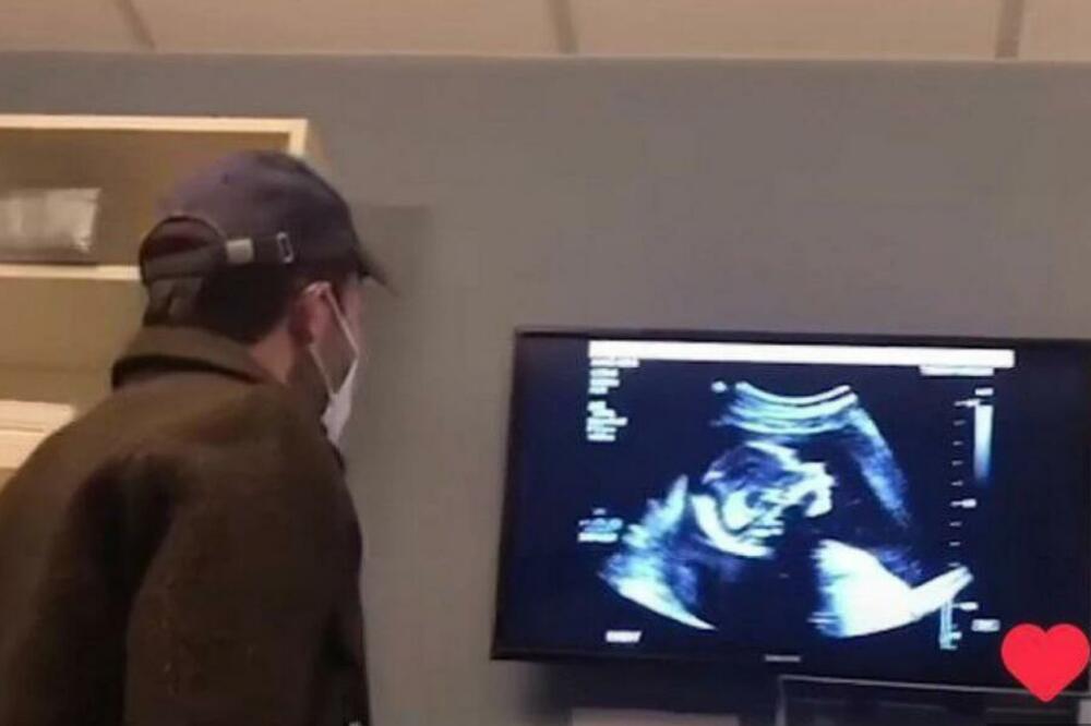 "KAKAV ČOVEK, DA LI JE TO MOGUĆE"?! Tata prvi put ugledao svoju bebu na ULTRAZVUKU, a tek kakva je NJEGOVA REACKIJA