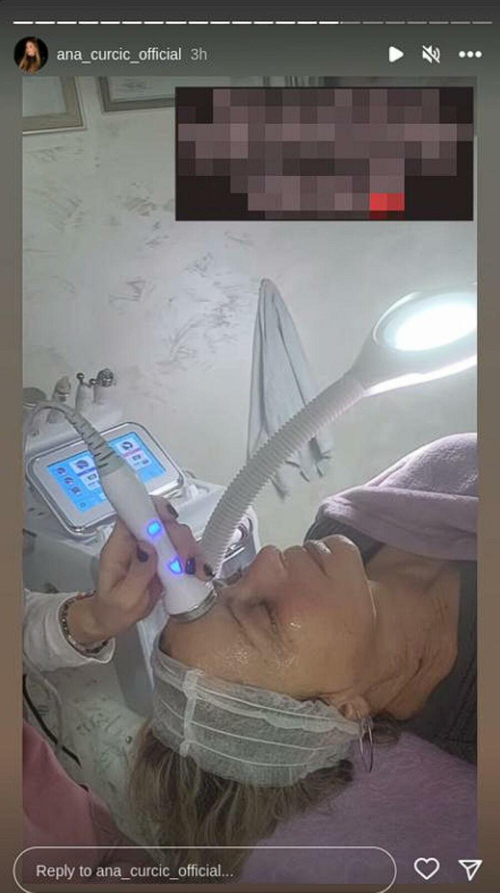 Na svom Instagram profilu podelila je fotografiju na kojoj se jasno vidi da je otišla na remont lica.