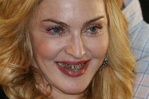 MADONINE PRVE FOTOGRAFIJE NAKON IZLASKA IZ BOLNICE: Svi ljudi KOMENTARIŠU samo jedno