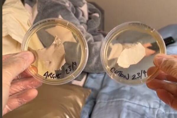 OVA STVAR VAM SE "MOTA" PO LICU DOK SPAVATE U KREVETU: Snimak otkrio JEZIVU STVAR, evo kako izgleda NAKON 7 DANA