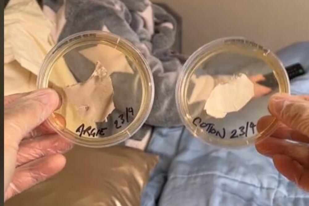 OVA STVAR VAM SE "MOTA" PO LICU DOK SPAVATE U KREVETU: Snimak otkrio JEZIVU STVAR, evo kako izgleda NAKON 7 DANA