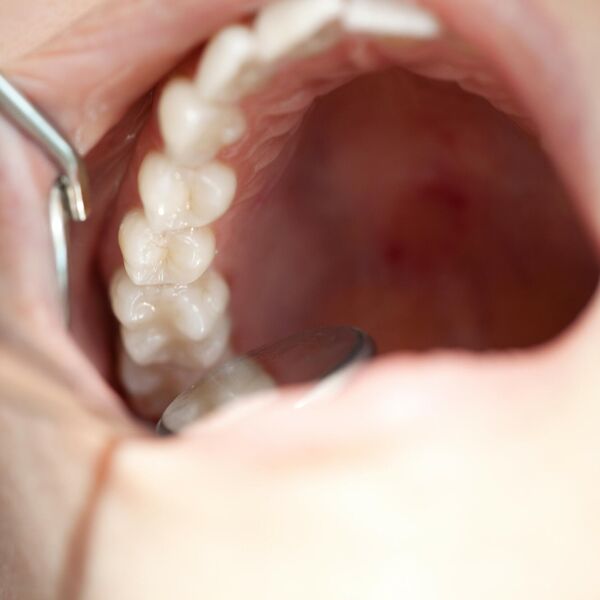 Da li redovno perete zube i idete kod zubara? Ako ste lenji onda ćete imati problem sa ovim bolom - nije za šalu