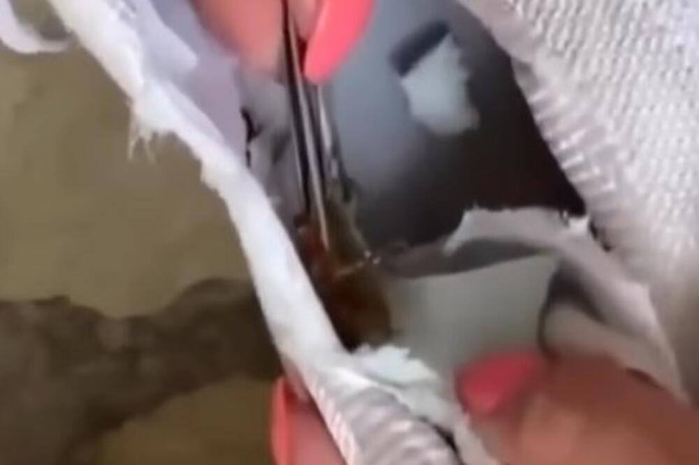 KUPILA JE PATIKE, A POTOM OSETILA DA JE NEŠTO ŽULJA: Ono što je IZVADILA, može SVAKOG da snađe, OGROMNO JE (VIDEO)