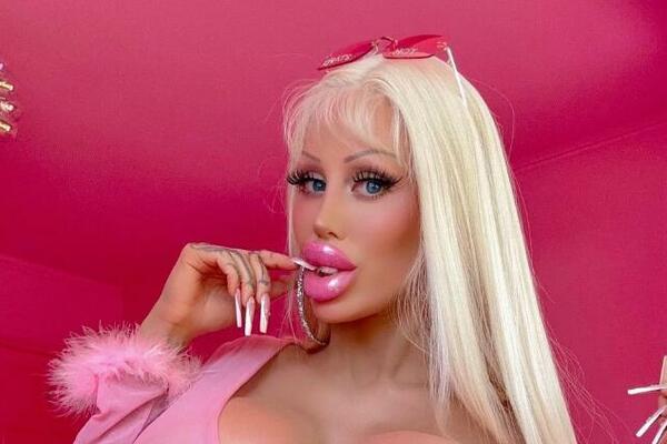 NA IZGLED POTROŠILA PREKO 100.000 EVRA: Operisala se od GLAVE do PETE, a ZAHTEV koji ima od MUŠKARACA je FRAPANTAN