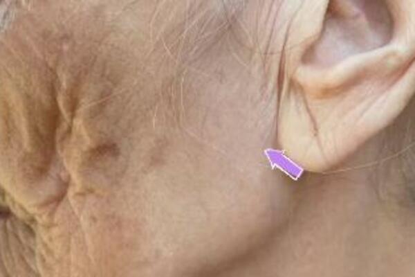 BAKA SKINULA MARAMU POSLE 96 GODINA: Razlika u KOŽI lica i vrata je neverovatna - I dalje želite na SUNCE? (VIDEO)