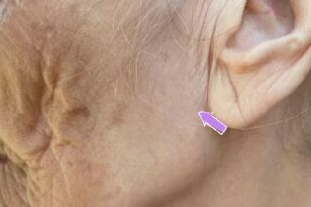 BAKA SKINULA MARAMU POSLE 96 GODINA: Razlika u KOŽI lica i vrata je neverovatna - I dalje želite na SUNCE? (VIDEO)