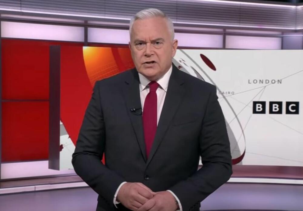 Hju Edvards završio u bolnici